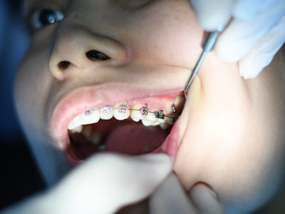Orthodontics and Dentofacial Orthopedics